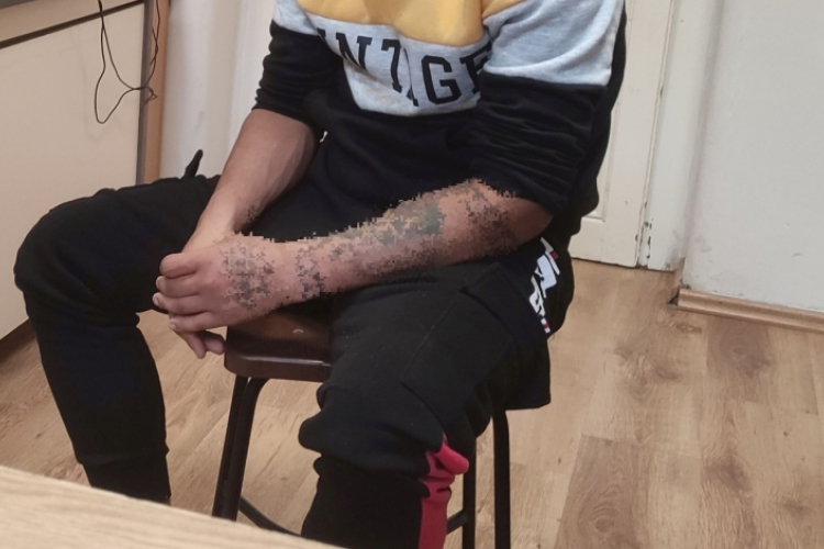 Kifosztottak két nőt és egy férfit a fiatalok